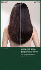 scalp solutions stimulating scalp massager